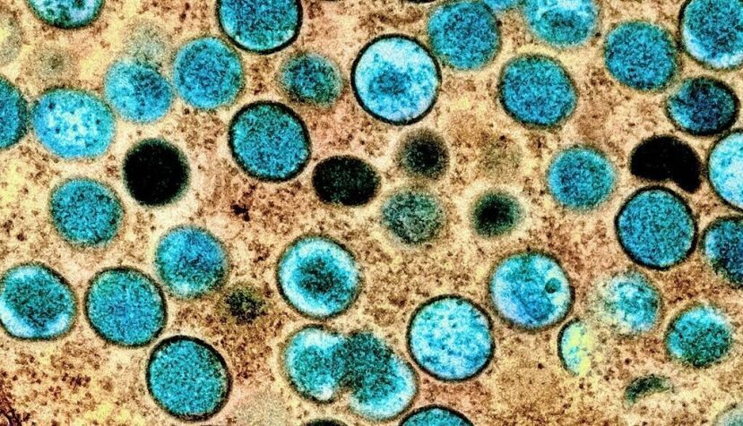 Imagen coloreada de partículas de viruela del mono en una célula infectada (marrón), cultivada en el laboratorio.Crédito: NIAID. Flikr NIAID , CC BY-SA