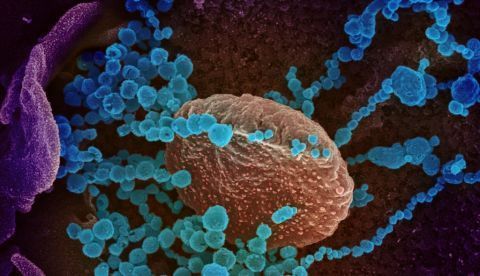 Científicos chinos descubren cómo el coronavirus se une a las células humanas/EFE/ NIAID-RML
