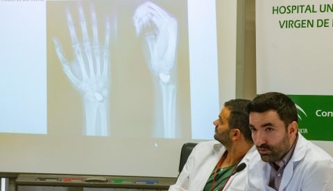 Enrique López Herrada (i) y David Peris (d), médicos responsables del equipo de Neurotraumatología y Rehabilitación del Hospital Virgen del Rocío de Granada y de la intervención a un joven al que han implantado una prótesis personalizada y elaborada en 3D, durante una rueda de prensa celebrada esta tarde en el hospital granadino. EFE/Miguel Angel Molina