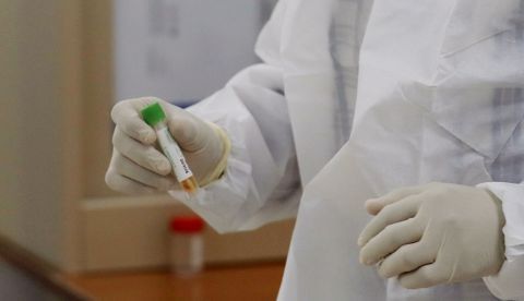 Científicos identifican cepa del virus más contagiosa, pero otros discrepan/EFE/EPA/YAHYA ARHAB