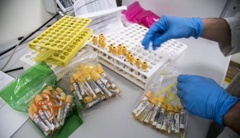 Investigadores disciernen la proteína animal de la vegetal en sangre/EFE/EPA/LUCA ZENNARO