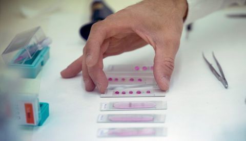 Un técnico del Instituto de Ciencia y Tecnología Ambiental (ICTA) realiza un estudio de alergia. EFE/Quique Garcia/Archivo 	   