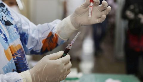 El nivel de anticuerpos de la gran mayoría de las personas infectadas mostró una disminución significativa dos o tres meses después de la infección. EFE/EPA/FAROOQ KHAN