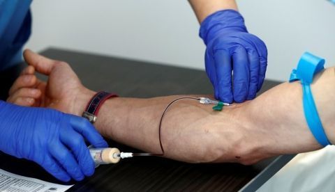 Un análisis de sangre detecta tumores cuatro años antes que los métodos convencionales/EFE/ Jesús Diges