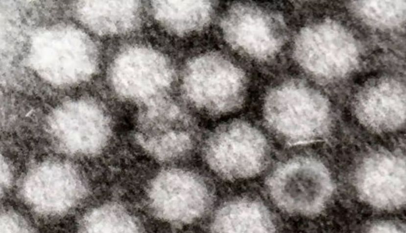 Virus adenoasociados- Wikimedia Commons / Dr Graham Beards , CC BY-SA
