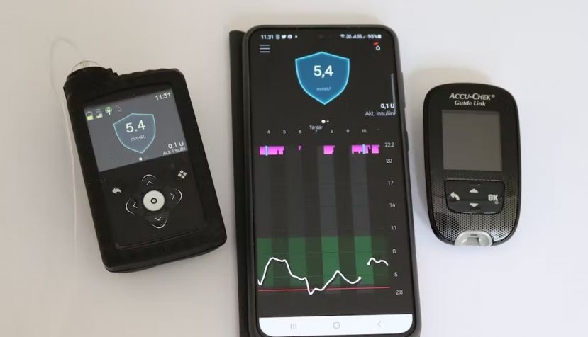 A la izquierda una bomba de insulina que incluye inteligencia artificial. En el centro un teléfono móvil con la aplicación de visualización. A la derecha un glucómetro de calibración. MailariX / Wikimedia, CC BY-SA