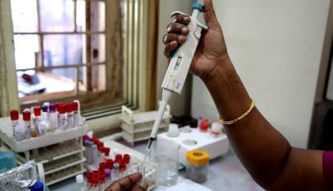 Este método, que aún está en fase de pruebas, proporcionaría una herramienta no invasiva para localizar nidos de parásitos, responsables de la mayoría de las trasmisiones de malaria en entornos de bajos recursos. EFE/Archivo