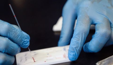 Realización de test serológico para valorar la situación por la pandemia del coronavirus. EFE/Nacho Gallego/Archivo