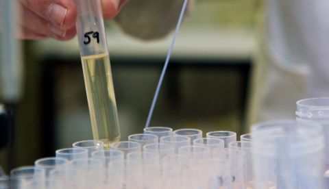 Investigadores del Vall d'Hebron Instituto de Oncología (VHIO) han logrado desarrollar un nuevo tratamiento, que se ha probado con éxito en ratones y que esperan probar en fase de ensayo clínico en humanos en 2020, para inhibir un gen que causa, entre otros, el cáncer de pulmón más agresivo. EFE/Archivo