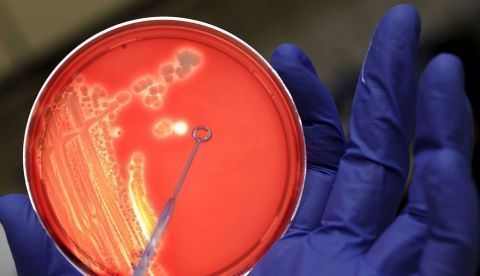 Una nueva combinación de antibióticos eficaz contra el 60 % de las neumonías hospitalarias / EFE