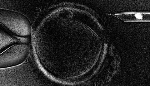 Fotografía facilitada por el Centro Embryotools, de la técnica de la Transferencia de Huso Materno (MST, en sus siglas en inglés) es que permite que mujeres que no consiguen el embarazo con tratamientos in vitro convencionales -que usan el material ovárico de la paciente-, puedan hacerlo con la ayuda de una donante de óvulos pero sin renunciar al propio material genético. EFE 	   