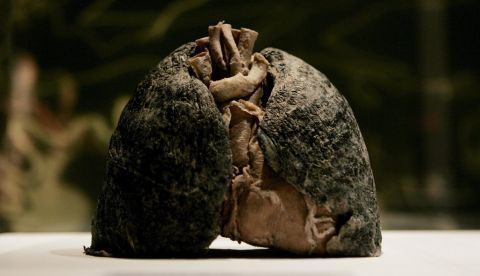 Cáncer de pulmón: la tasa mundial de mortalidad en mujeres aumentará un 43% / EFE