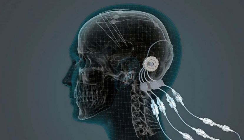 De nuevo el cerebro