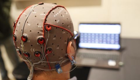 Imagen de archivo de una estimulación eléctrica cerebral con electrodos. EFE/Alejandro García/Archivo 	   