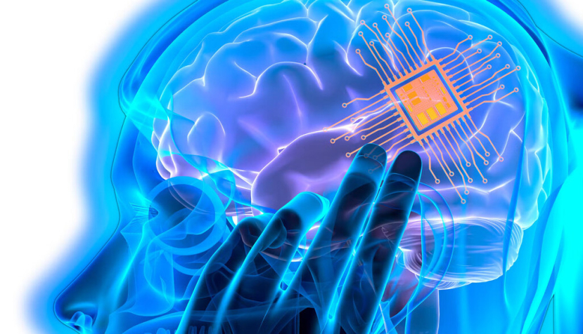 El implante cerebral chino, NEO, marca un cambio de era en la medicina y la sociedad
