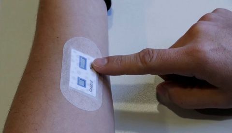 Un equipo de científicos españoles ha desarrollado un nuevo dispositivo inteligente, basado en una batería de papel de 8 centímetros de largo por 4 de ancho, que facilita el diagnóstico de la fibrosis quística, la enfermedad rara más común en Occidente y que en España la padecen alrededor de 2.500 personas. La descripción de este dispositivo, una especie de parche o tirita que se pega en la piel, se publica en la revista Microsystems &amp; Nanoengineering y, según sus autores, permitirá realizar la detección "mucho más temprana" de una enfermedad crónica y, en general, progresiva que normalmente se inicia durante la niñez. EFE/CSIC 	   