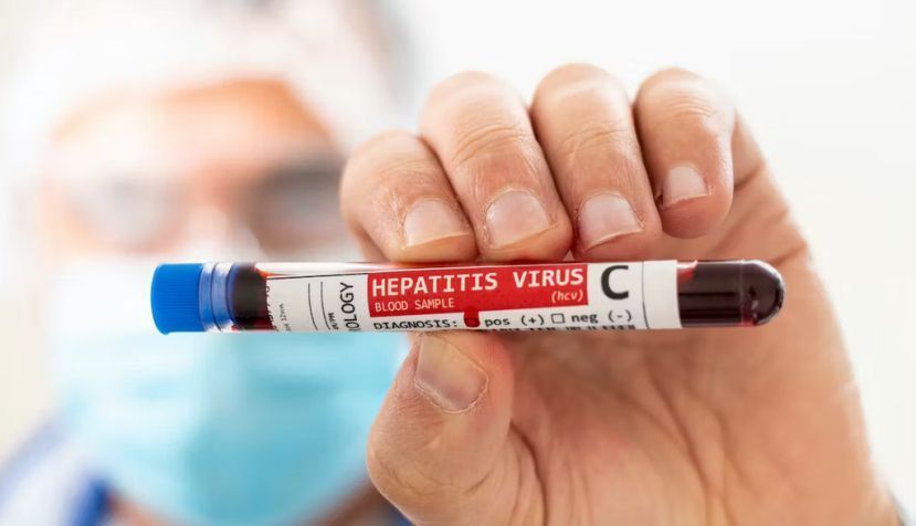 Por qué aún no hay vacuna contra la hepatitis C y es tan importante desarrollarla