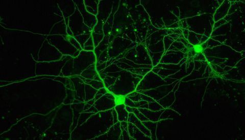 La explosión neuronal que transformó el cerebro de los anfibios en humano / EFE