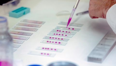 Un técnico del Instituto de Ciencia y Tecnología Ambiental (ICTA) realiza un estudio de alergia poco antes de la rueda de prensa en la que han alertado de nuevos alérgicos a partir de la alta concentración de polen. EFE 	   