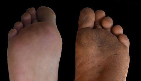 Este tipo de protuberancias se desarrollan para ofrecer protección en superficies incómodas o resbaladizas, destacaron los investigadores, quienes estudiaron los pies de 81 adultos kenianos y 22 estadounidenses. EFE/Nature 	   