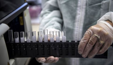 Descubren cómo infecta una bacteria urogenital resistente a los antibióticos/EFE/EPA/Julien de Rosa