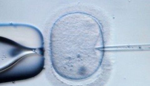 Imagen de archivo de una fecundación in vitro. EFE
