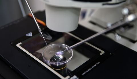 Fertilización in vitro. EFE/Ernesto Arias