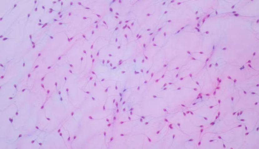  Vista de esperma humano al microscopio. Shutterstock / Komsan Loonprom