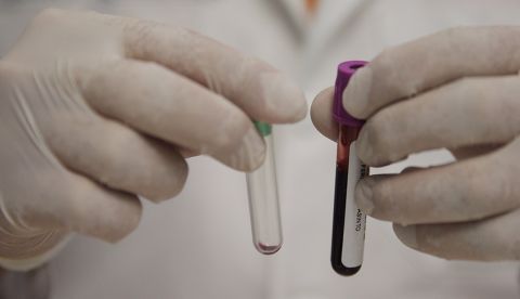 Según los médicos, las tres personas analizadas presentan una compleja combinación de factores genéticos, virológicos e inmunológicos que les permite un control extremo de la infección, que se produce sólo si se dan simultáneamente todos estos factores. EFE/Sáshenka Gutiérrez/Archivo