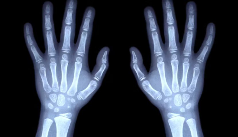 Huesos de la mano de un niño. Puwadol Jaturawutthichai/Shutterstock