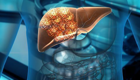 Una vía genómica podría prever el cáncer de hígado con 2 décadas de antelación