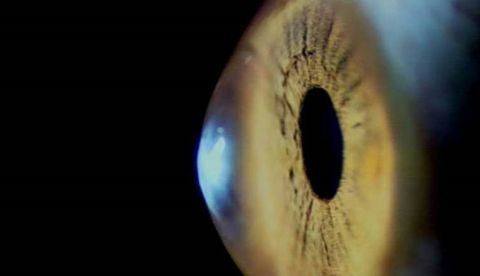 La córnea, la lente más externa del ojo, se debilita con el paso del tiempo.  Un equipo multinacional de científicos ha desarrollado ahora nuevas técnicas de imagen que permitirán intervenir de una forma no invasiva a pacientes con enfermedades corneales y glaucoma.  Imagen facilitada por el CSIC. EFE
