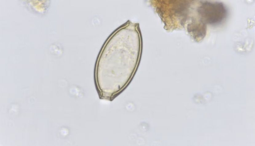 Huevo de Trichuris sp., hallado en restos óseos procedentes de material arqueológico. R. López- Gijón, Author provided
