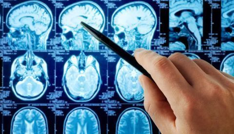  Imágenes de varios cerebros obtenidas por resonancia magnética. Triff / Shutterstock