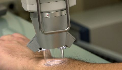 La investigación encontró que la utilización simultánea de tres drogas trajo como resultado una vida más larga para pacientes con este tipo de melanoma, al igual que un freno de la expansión del cáncer. EFE/Archivo 	   