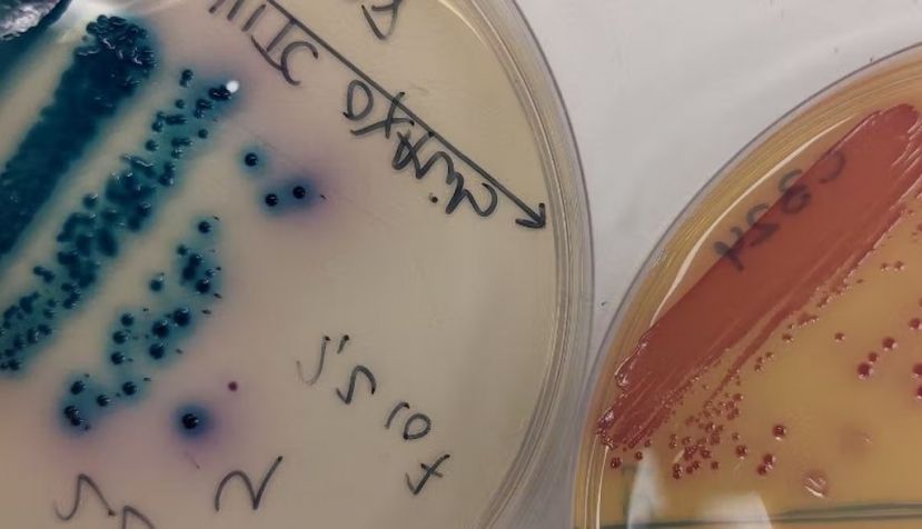 Placas de petri con cultivos de bacterias resistentes a antibióticos aisladas de pacientes. En azul puede observarse a ‘Klebsiella pneumoniae’, y en rojo, a ‘Escherichia coli’. Author provided