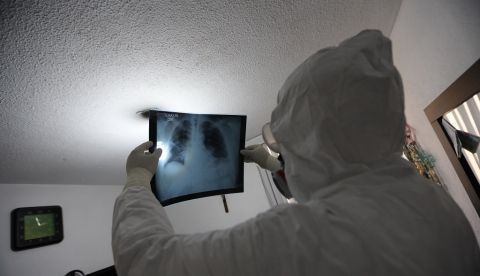 Los sistemas basados en Inteligencia Artificial ayudan y mejoran la predicción del radiólogo. EFE/Sáshenka Gutiérrez/Archivo