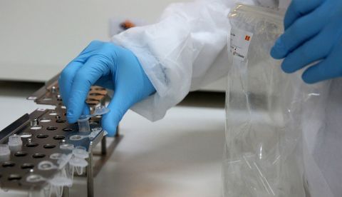Evidencian el papel clave de una proteína en la hipertrofia cardíaca/EFE/EPA/ORESTIS PANAGIOTOU